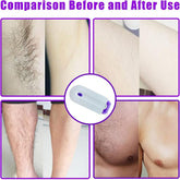 Portable Painless Hair Removal Tool